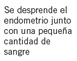 opcion1